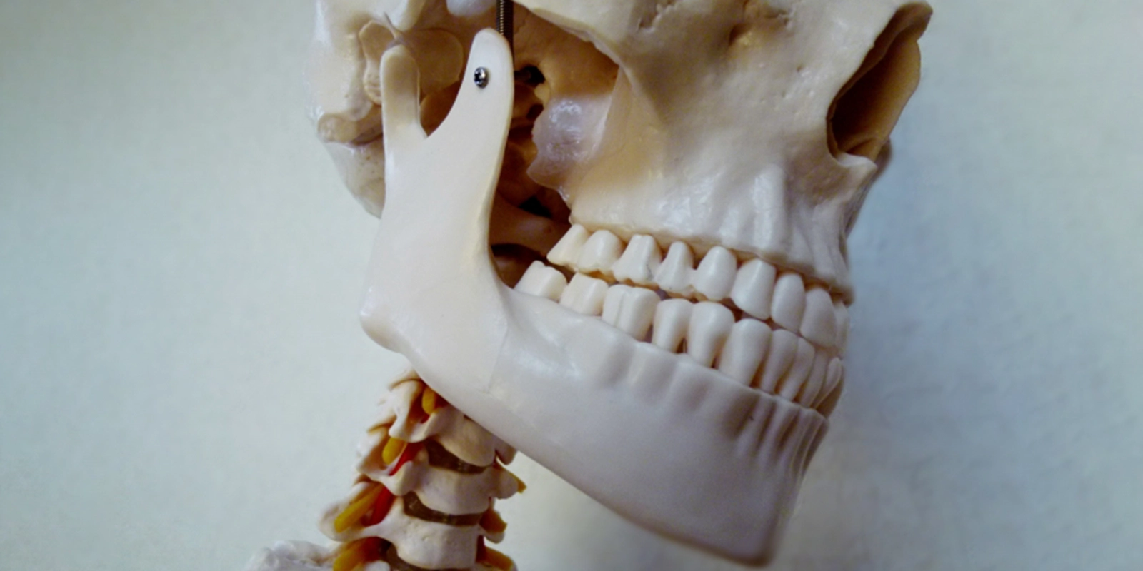 歯ぎしりの治療法