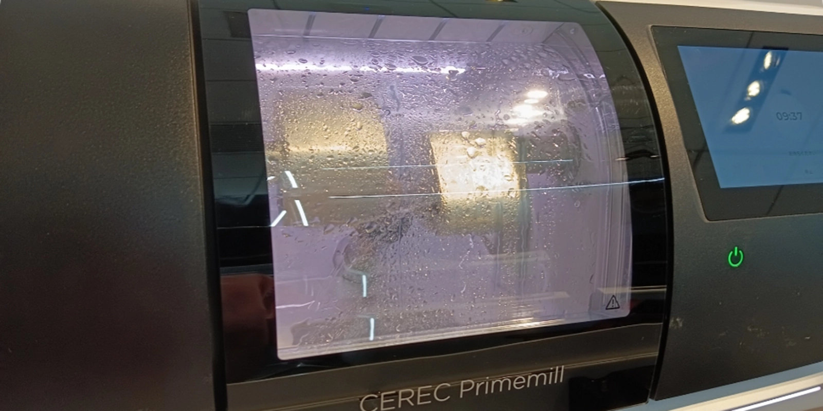 セレック治療とは