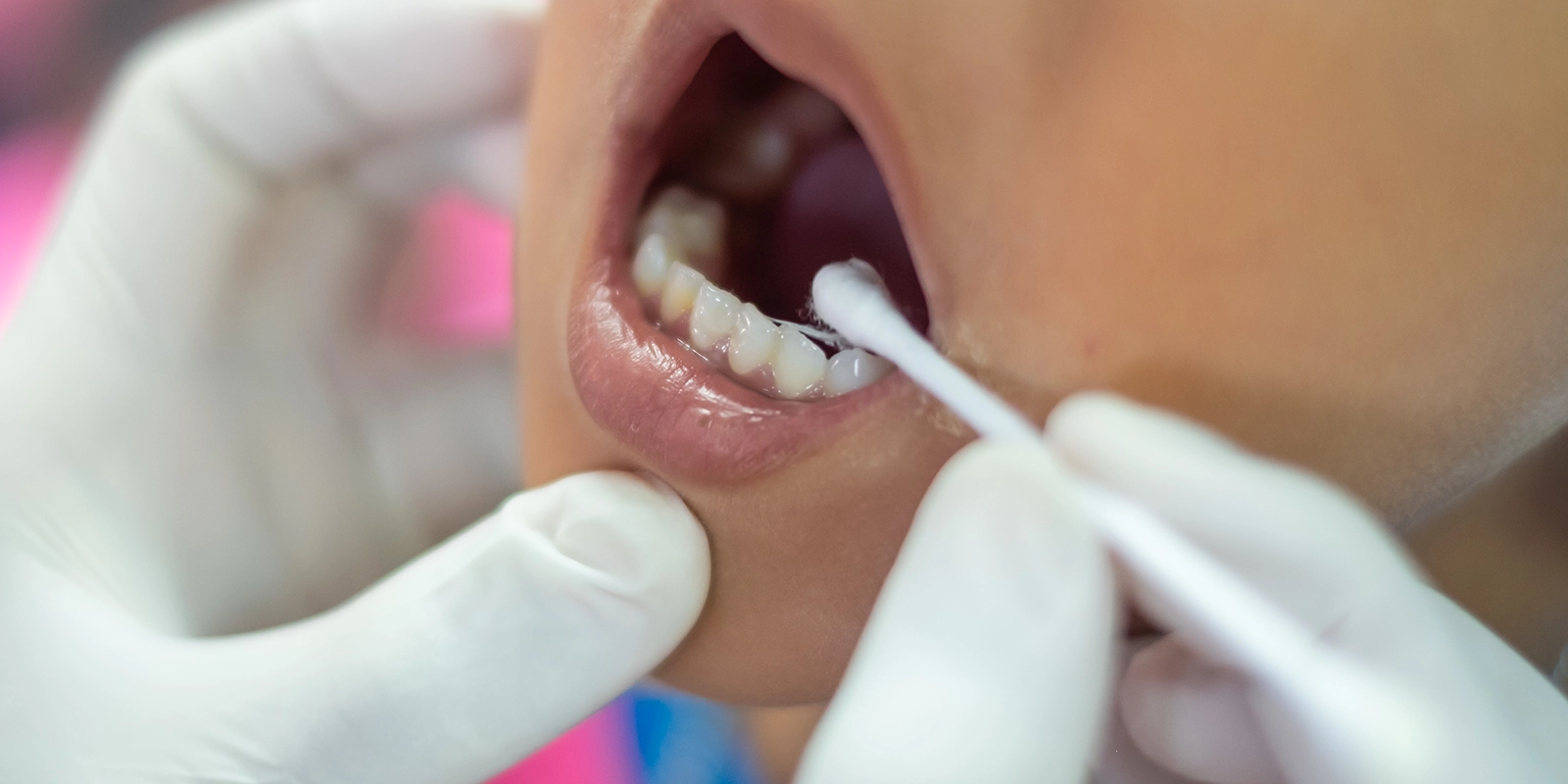 歯科治療を嫌がるお子様への対応