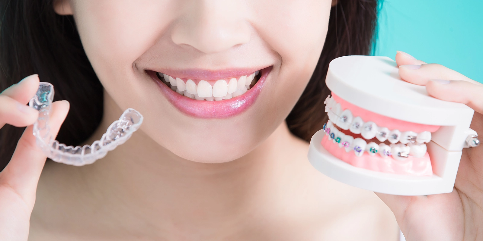 矯正治療の流れ