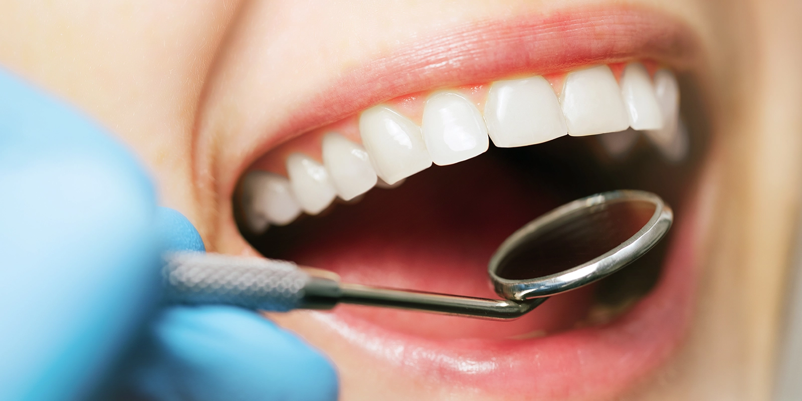 メンテナンスの流れ