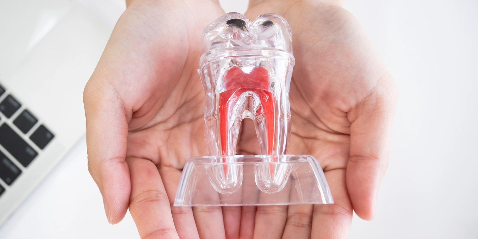 根管治療の重要性