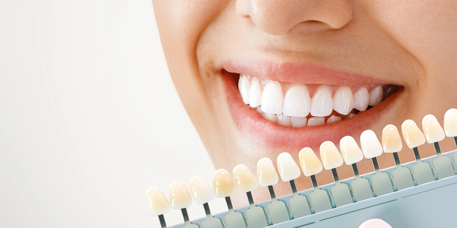 ホワイトニングとは