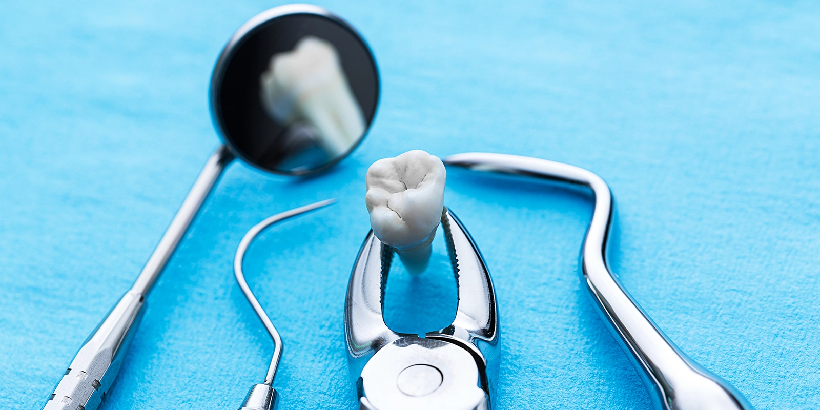 親知らず抜歯の流れ